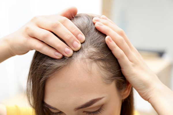 Rụng tóc, tóc mỏng đi là dấu hiệu của lão hóa