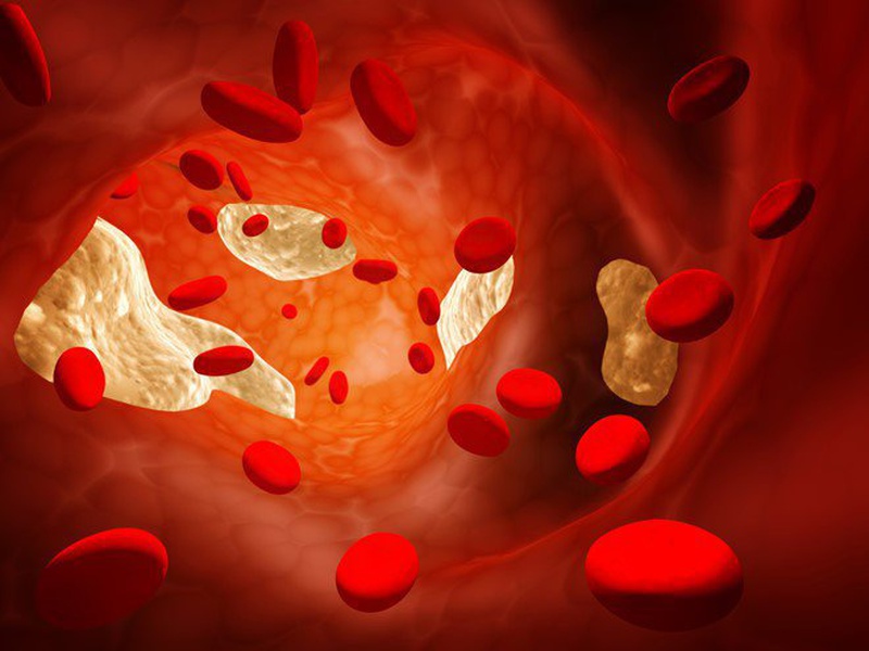 Chất xơ hòa tan giúp giảm cholesterol máu
